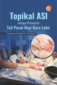 Topikal ASI Sebagai Perawatan Tali Pusat Bayi Baru Lahir