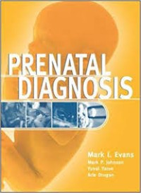 Prenatal Diagnosis