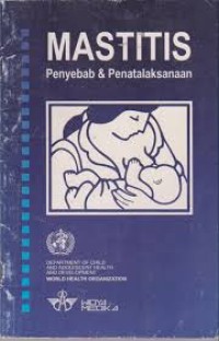 MASTITIS: Penyebab dan penatalaksanaan