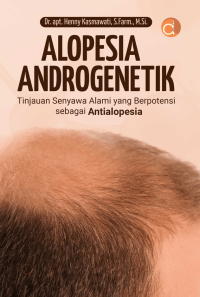 Alopesia Androgenetik Tinjauan Senyawa Alami yang Berpotensi sebagai Antialopesia