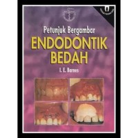 Petunjuk Bergambar: ENDODONTIK BEDAH